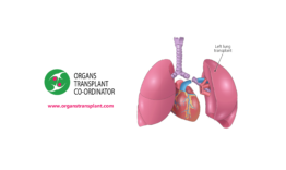Lung transplant - healthsansar.com